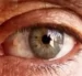 تزریق آواستین توسط فوق تخصص شبکیه چشم