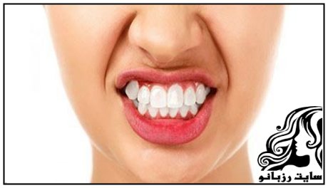 عوامل و علل دندان قروچه