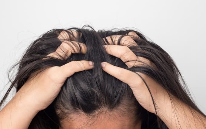 https://up.rozbano.com/view/3038503/Dandruff%20and%20itching%20of%20the%20head-04.jpg