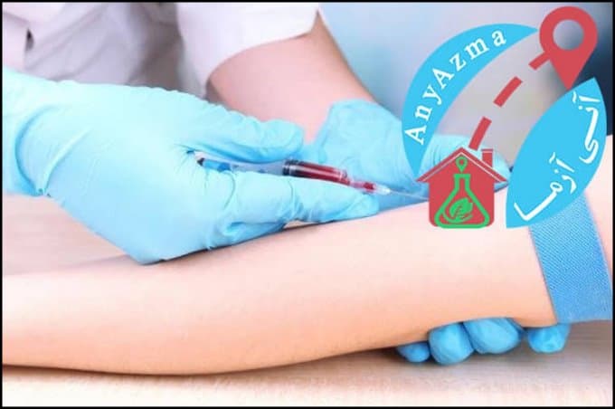 https://up.rozbano.com/view/3083407/A%20few%20hours%20before%20fasting%20blood%20tests-04.jpg